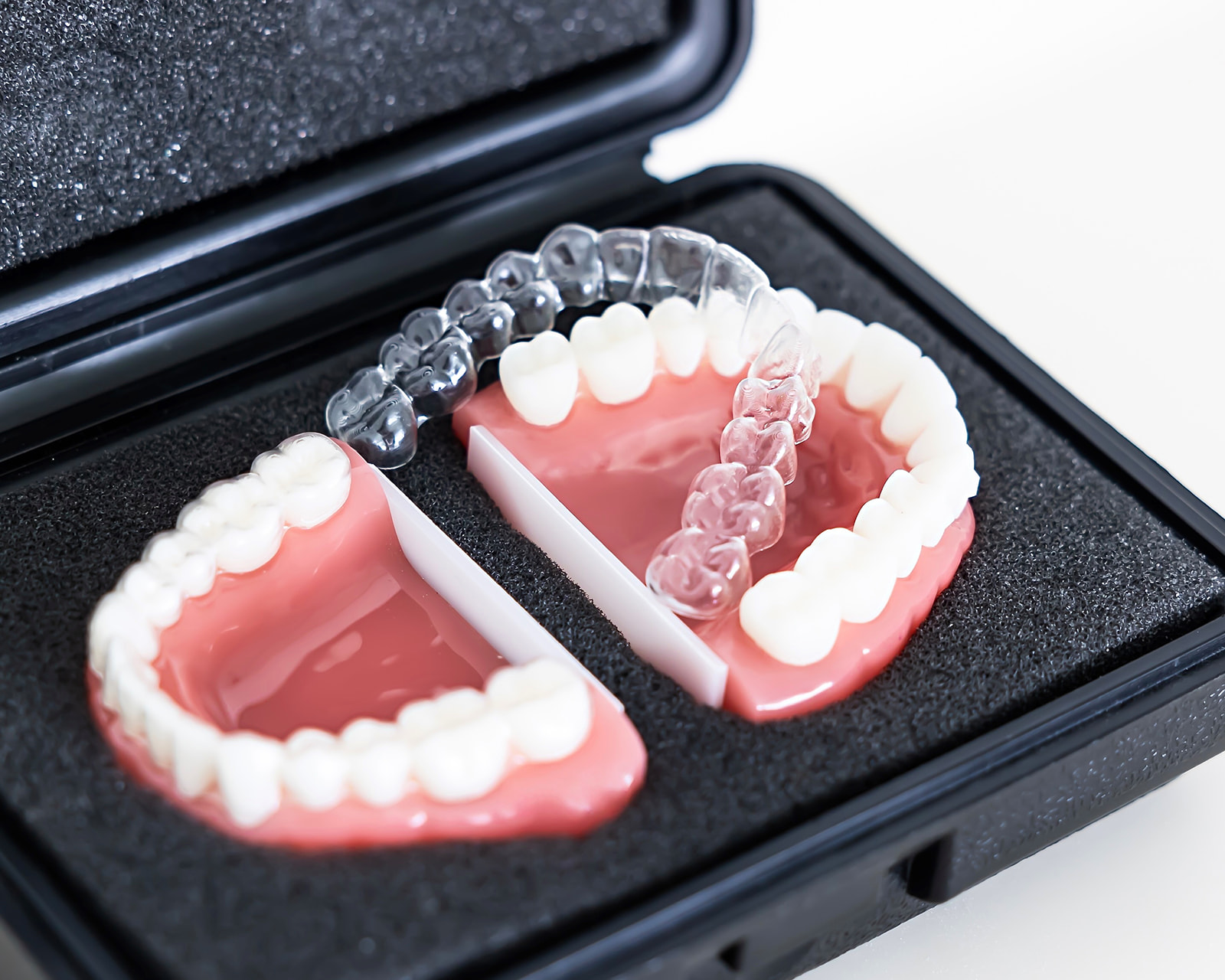 Modelos dentales en una caja negra, mostrando dientes superiores e inferiores con alineadores transparentes colocados en la arcada superior