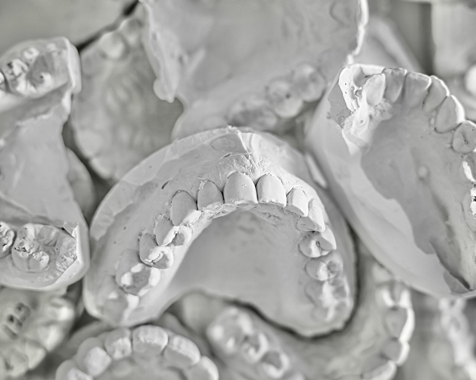Primer plano de varios moldes dentales de yeso blanco mostrando detalles de dientes y encías. Los moldes están apilados y se pueden ver claramente las formas de los dientes y las arcadas dentales.