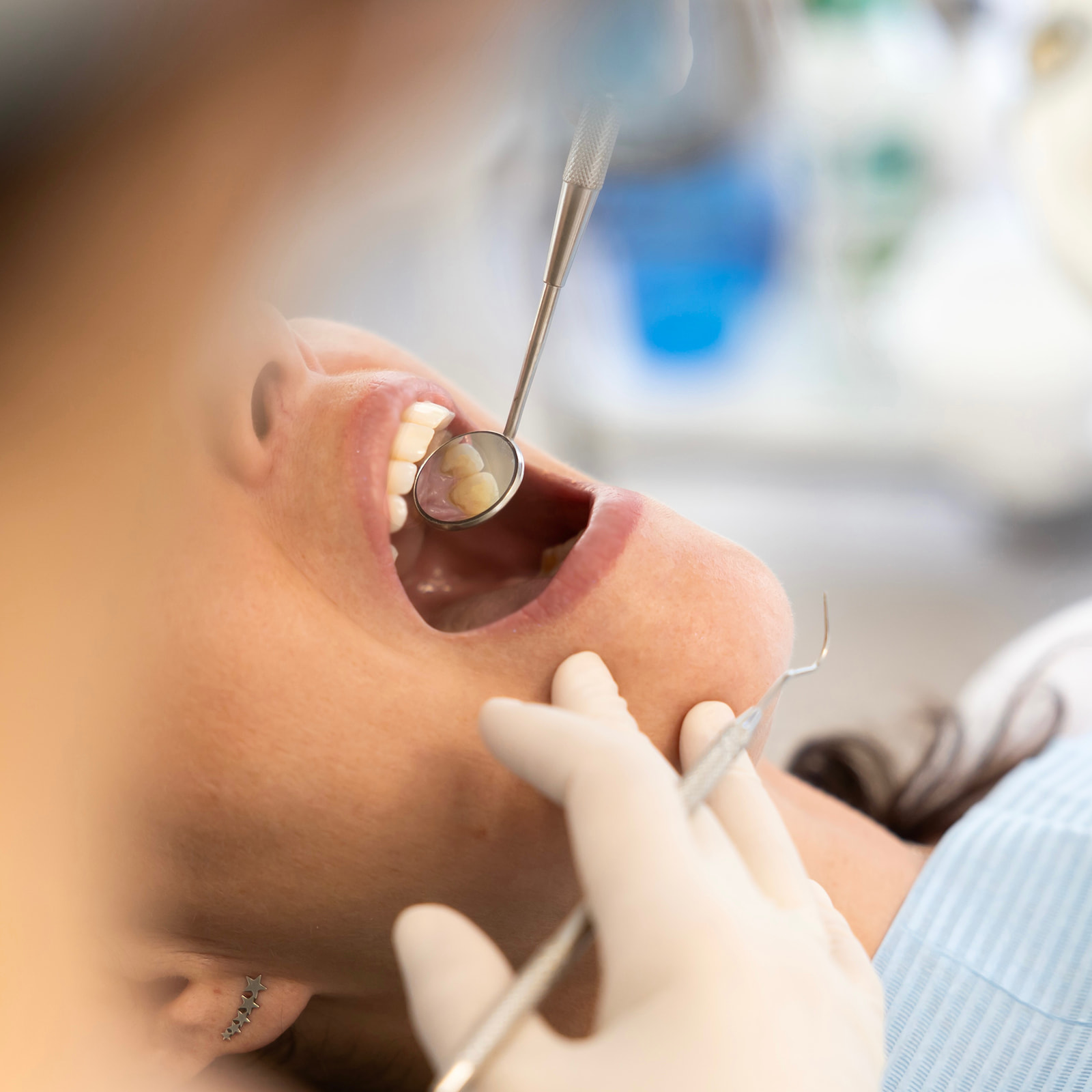 Primer plano de un examen dental donde se observa un espejo bucal inspeccionando los dientes de un paciente. Las manos enguantadas del dentista sostienen el instrumento mientras examinan la boca abierta.
